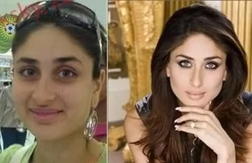 actress plastic surgery before after buccal fat removal